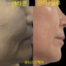 개봉푸르지오 정문 | [개봉역 뷰티스킨케어] 콜라겐 퍼밍 인텐시브 7.0후기 ㅣ 7일만에 달라진 50대 리프팅 탄력변화
