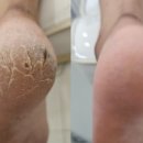 김혜진네일 앤 풋시스 네이버블로그