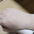 다크린 외용액 연고 사용 후기 여드름 연고 의사 처방 내돈내산