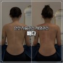 고잔2길 | [안산 지흡관리] 체형관리부터 굽은등 케어까지! 빼다 관리후기
