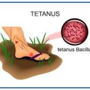 손가락 파상풍 증상 원인 주사기간 파상풍 치료 얼마나 걸릴까? 이미지
