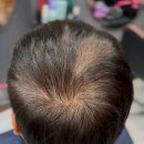 마리오 소프트 | 홈염색 이력 모발 모로칸오일 탈색 후 컬러 염색 후기