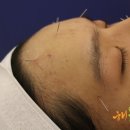 해봄한의원 이미지