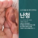 에코보청기 청각난청센터 구로점 | 개봉동보청기 이어폰 많이 쓰면 난청 오나요