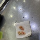 오제석치과의원 | [광주]오제석치과 - 사랑니 졸업 저는 이제 사랑니 없습니다!