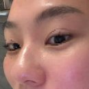 디톡스 | 화명동피부관리 올가드림뷰티 화명점 모공디톡스 후기 / 부산여드름 고민피부 추천