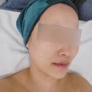 랑호프 | 대구 윤곽관리 피오라뷰티샵 탄력까지 잡은 찐 후기