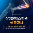 삼성본어스병원 | 소사 정형외과 삼성본어스병원 무지외반증 MICA 치료 알아본다면