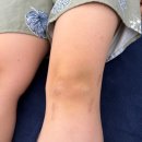 국가대표 체형교정센터 | 논현체형교정 국가대표도 가는 재활운동 센터 '새몸바디케어'에서 십자인대 무릎 부담 줄이기