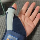 이창훈한의원 | 손목 건초염 치료 후기 수술해야할지도