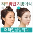 하트라인