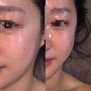 무전대로 | [통영] 통영 피부관리, 수기관리 추천 하얀얼굴, 하이푸 리프팅 후기