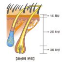 화상 (Burn) 이미지