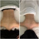 림프마사지 | 나비효과에스테틱 강남본점 | 림프 전문샵 강남에스테틱 전신 림프순환마사지 후기