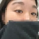 영구있지 | 파주 운정 애교살 음영 반영구 내돈내산 후기 리터치까지 솔직 리뷰 / 15만원 애교살 반영구 결과는?