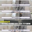 스타성형외과의원 | 서면 눈밑지, 절개 쌍수, 눈매교정 후기 스타비성형외과