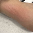 민염색카페 | [후기]이유없는 콜린성 알레르기 영양제 디스타민 /후기/내돈내산