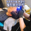 예양 | 극심한 두피트러블로 웰킨용인수지점 방문한 솔직후기