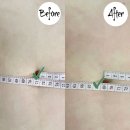 유마인힐 | [대구/달서구] 복부 경락 다이어트 신부관리 4회차 ❝은가비피부관리❞