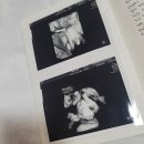 순천기독의원 | [임신 후기] 산부인과 전원 - 출산 병원으로 옮기기!, &#39;눕눕&#39; 처방 - 자궁경부 길이가 짧아요, 나의...