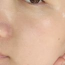 보람메디컬 이미지