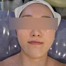 운정피부관리 웨딩관리 추천 티리온 후기(Feat.라끄스킨)/ 온다리프팅 차이