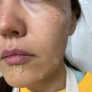 제주케어메디칼 | 제주 노형동 연동 피부과 잡티제거 솔직후기