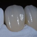 마이크로치과기공소 이미지