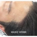 고도헤어 이미지