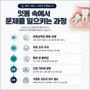관악전치과의원 | 관악치과 사랑니 통증 참는다고 해결되지 않습니다