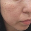 힐비뇨기과의원 이미지