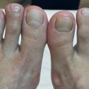 레푸스 구로점 이미지