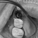 애플치과기공소 이미지