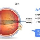 P-6517 네이버블로그