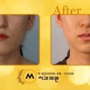 예쁜브이라인의원 이미지