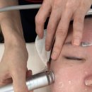 아미스킨 | [광주 스킨케어] 진월동 아미에스떼 예민한 피부 홍조 관리 후기