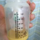 으라차차 유도짐 구남점 | 다사로즈맘산부인과, 제왕절개후기, 주절주절