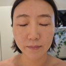 스마트에스테틱 | 잠실 얼굴윤곽관리 추천 인하에스테틱 엔더몰로지페이스 후기