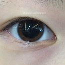 (주)비비지바이오 | 초등어린이 드림렌즈 구매기(?!) ,신촌새빛안과