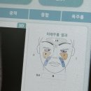 미래 카 클리닉 | 부산 서면 피부관리 미백관리 전문 카리언뷰티클리닉 에스테틱 잡티제거 비용 횟수 자세한 후기