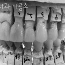 원치과기공소 이미지