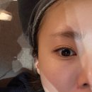 (유)창해 | 서면바노바기 리쥬란힐러 효과 및 통증 솔직후기