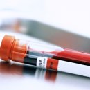 힙스청담의원 이미지