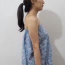 경희회오리한의원 | 마산현동피부관리 : 경희홍에스테틱에서 JH윤곽술 받고 리프팅된 후기