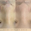 봄 에스테틱 네이버블로그