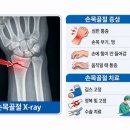 김포마디행복정형외과의원 | 김포 구래동 손목 발목골절 통증치료 병원은 어디?