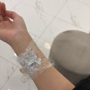 스무살봄의원 | 문신 제거 1일차