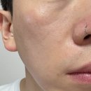 아쿠아 소프트 | [피몽쉐] 남자 비비크림 피몽쉐 아쿠아 블레미쉬 커버밤 뉴트럴 소프트 베이지 사용 후기