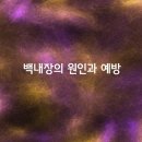 백내장의 원인과 예방에 좋은 음식 이미지