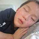 대한모타 | 초1남아 아토피, 피부과 치료 후기(광선치료 및 스테로이드 큐모타손, 데소나 도포)